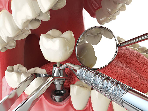 Best Emergency Dental Services for Seniors in Alderton, WA
