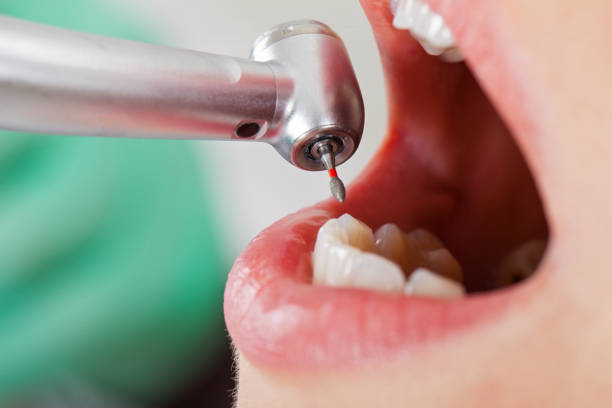 Best Mobile Emergency Dentist in Alderton, WA